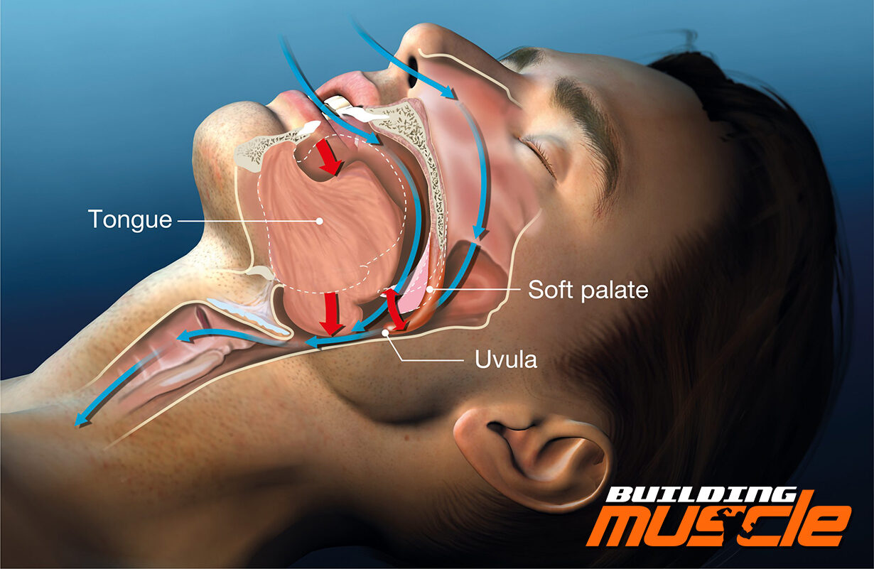 Sleep Apnea is the Natural Enemy of Testosterone